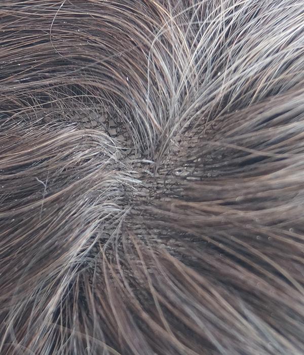 Skin - Brilliantwigs
