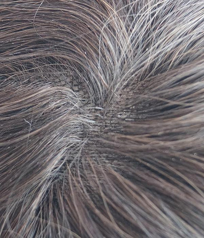 Skin - Brilliantwigs